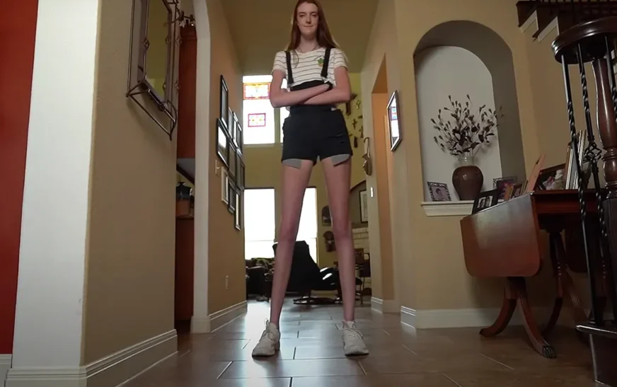 Maci Currin: La Joven que Conquistó el Récord Mundial por sus Piernas de 135 cm